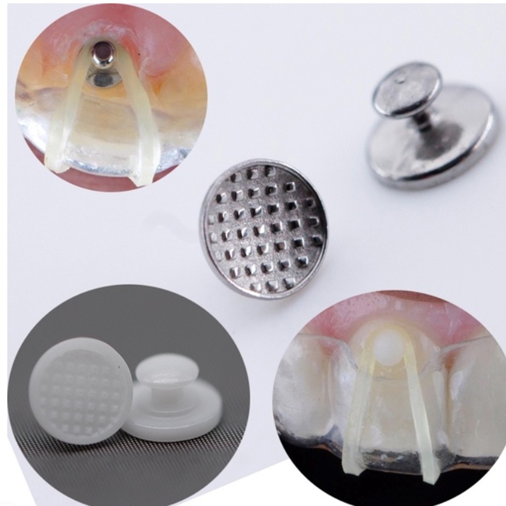 Dental Orthodontic Metal Lingual Button
